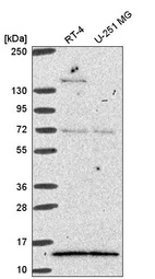 Anti-GTF2A2 Antibody