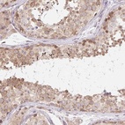 Anti-TBPL2 Antibody