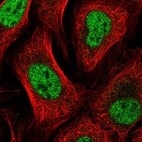 Immunofluorescent staining of human cell line U-2 OS shows localization to nucleoplasm.