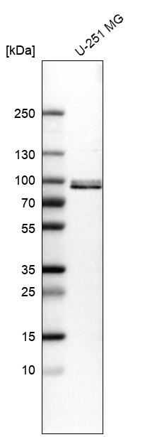 Anti-QSOX1 Antibody