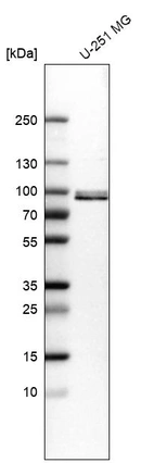 Anti-QSOX1 Antibody