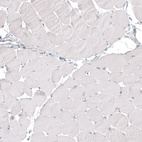 Immunohistochemical staining of human skeletal muscle shows no positivity in myocytes as expected.