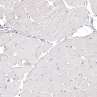 Anti-NAPSA Antibody