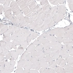 Immunohistochemical staining of human skeletal muscle shows no positivity in myocytes as expected.