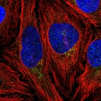 Immunofluorescent staining of human cell line HeLa shows localization to vesicles.