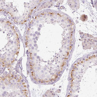 Immunohistochemical staining of human testis shows moderate cytoplasmic positivity in subset of cells in seminiferous ducts.
