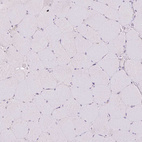 Immunohistochemical staining of human skeletal muscle shows no positivity in myocytes as expected.