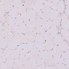Immunohistochemical staining of human skeletal muscle shows no positivity in myocytes as expected.