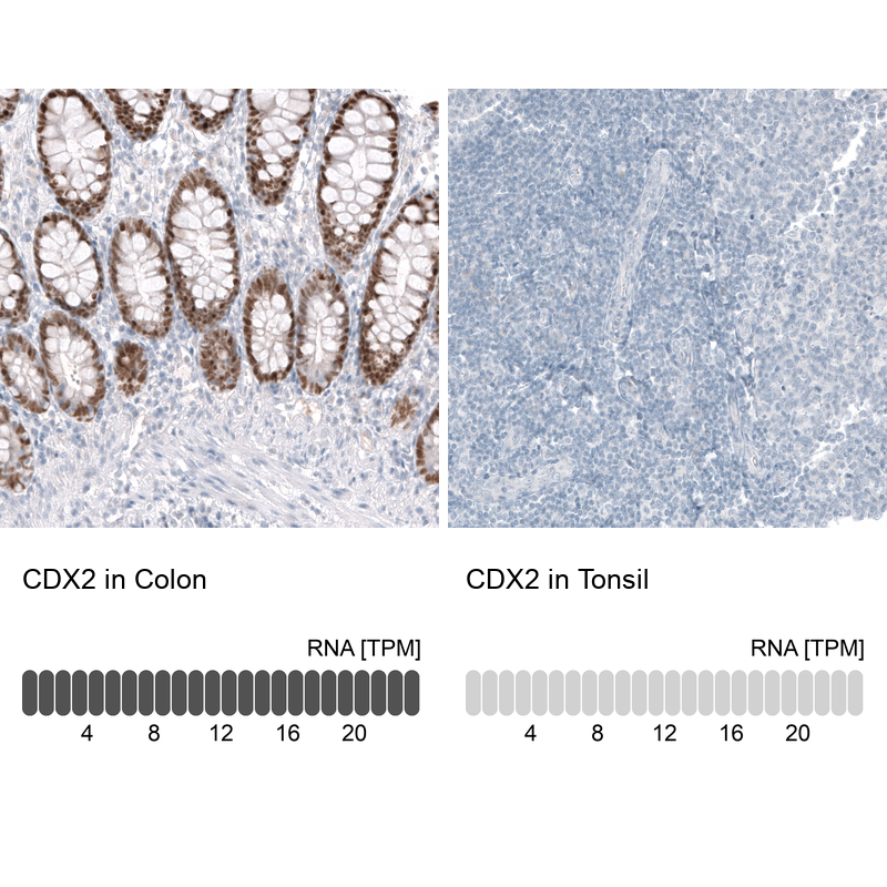 Anti-CDX2 Antibody