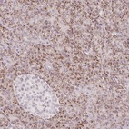 Anti-ZFP41 Antibody