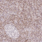 Anti-ZFP41 Antibody