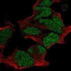 Anti-POU3F2 Antibody