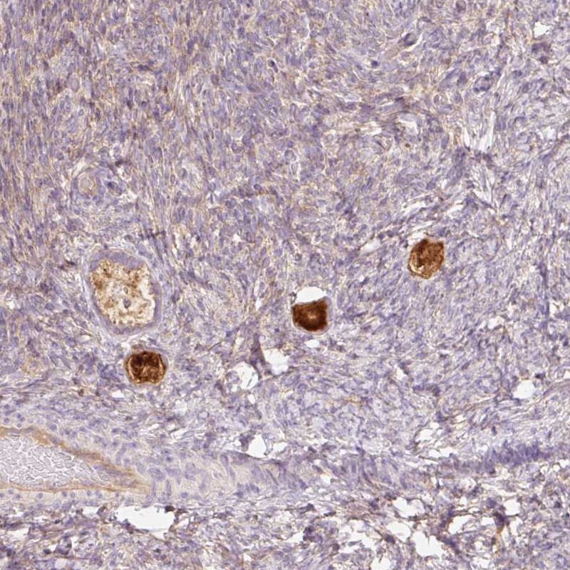 Anti-NLRP5 Antibody