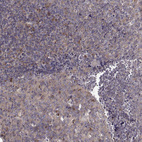 Immunohistochemical staining of human tonsil shows moderate cytoplasmic positivity in germinal center cells.