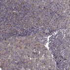 Anti-ARFGAP1 Antibody