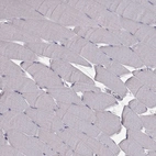 Immunohistochemical staining of human skeletal muscle shows no positivity in myocytes as expected.