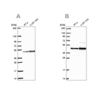 Anti-ARFGAP1 Antibody