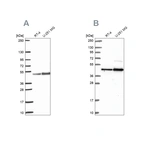 Western blot analysis using Anti-ARFGAP1 antibody HPA056273 (A) shows similar pattern to independent antibody HPA051019 (B).