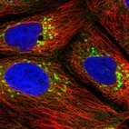 Immunofluorescent staining of human cell line CACO-2 shows localization to cytosol, the Golgi apparatus & vesicles.