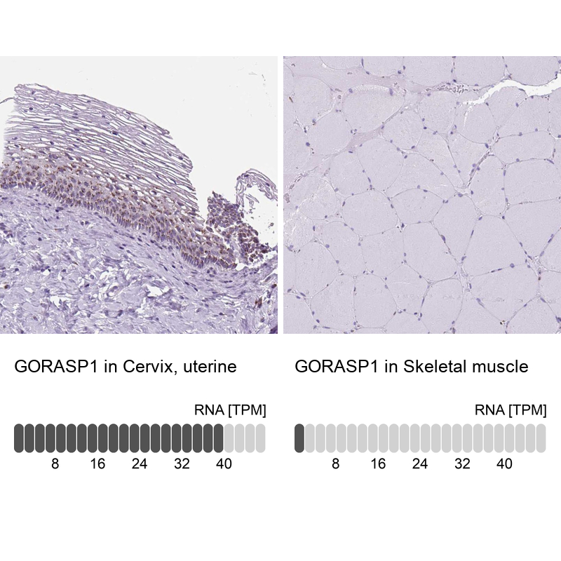 Anti-GORASP1 Antibody
