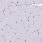 Immunohistochemical staining of human skeletal muscle shows low expression as expected.