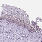 Immunohistochemical staining of human cervix, uterine shows high expression.