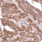 Anti-CDX2 Antibody