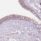 Anti-ESAM Antibody