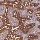 Immunohistochemical staining of human duodenum shows strong cytoplasmic positivity in glandular cells.