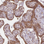 Anti-MINK1 Antibody