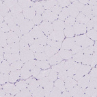 Immunohistochemical staining of human skeletal muscle shows no cytoplasmic positivity in myocytes as expected.