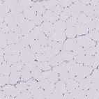 Anti-MINK1 Antibody