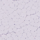 Immunohistochemical staining of human skeletal muscle shows no cytoplasmic positivity in myocytes as expected.
