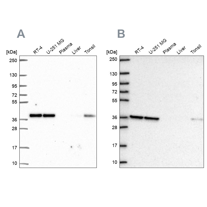 Anti-NUP37 Antibody
