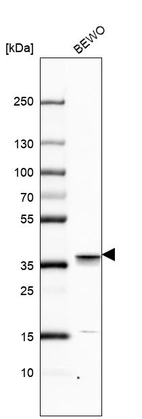 Western blot analysis in human cell line BEWO.