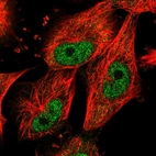 Immunofluorescent staining of human cell line U-251 MG shows localization to nucleoplasm.