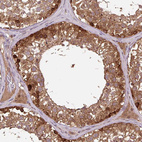 Anti-MMS19 Antibody