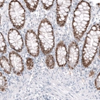 Immunohistochemical staining of human colon shows moderate to strong nuclear positivity in glandular cells.