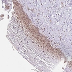 Immunohistochemical staining of human cervix, uterine shows moderate nuclear positivity in squamous epithelial cells.
