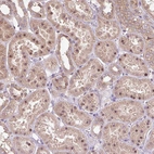 Immunohistochemical staining of human kidney shows moderate nuclear and cytoplasmic positivity in cells in tubules.