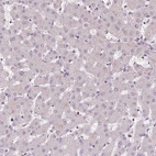 Immunohistochemical staining of human liver shows no positivity in hepatocytes as expected.