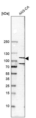 Anti-MMS19 Antibody