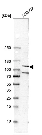 Western blot analysis in human cell line AN3-CA.