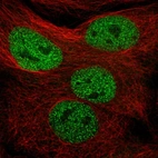Immunofluorescent staining of human cell line CACO-2 shows localization to nucleoplasm.