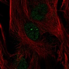 Anti-FOXC2 Antibody