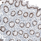 Immunohistochemical staining of human rectum shows strong nuclear positivity in glandular cells.