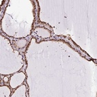 Anti-SGTA Antibody