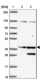 Lane 1: Marker [kDa] 250, 130, 95, 72, 55, 36, 28, 17, 10_br/_Lane 2: Human cell line RT-4_br/_Lane 3: Human cell line U-251MG sp