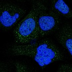 Anti-COL9A2 Antibody