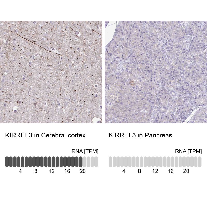 Anti-KIRREL3 Antibody